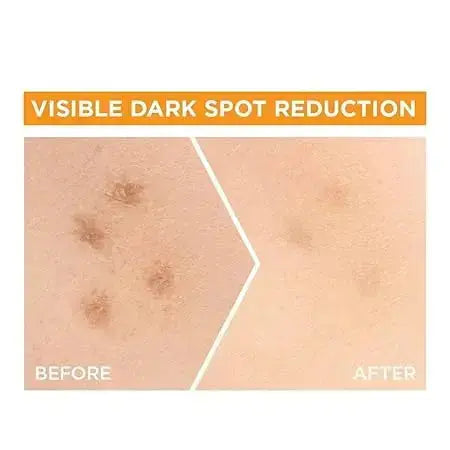 Garnier Bright Complete 30X Vitamin C Booster Serum 15 ml | Lightweight Gel for Brightening & Spot Reduction - USA Wholesale Trade